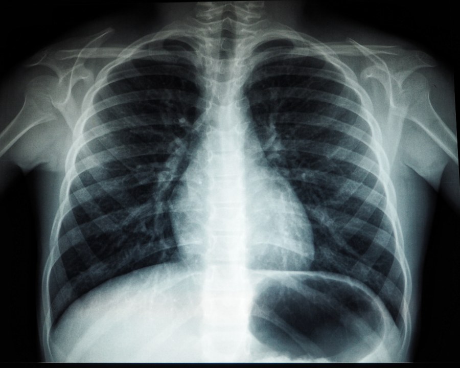 medical imaging machine learning example